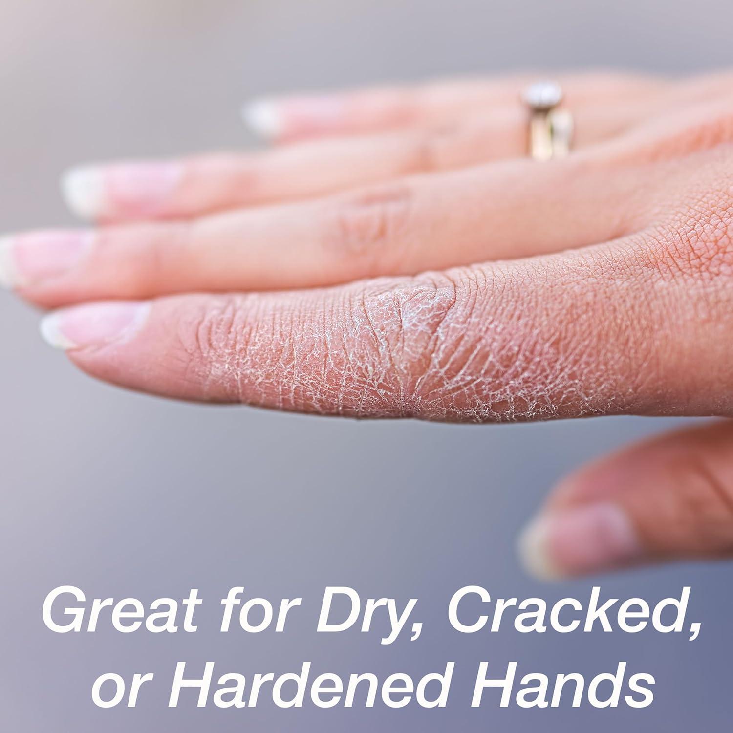 image:imageGel Spa Moisturizing Gloves 1 Pair Spa Gloves Infused with Essential Oils to Soften Skin amp Lock in Moisture Gel Gloves for Dry Cracked HandsGloves