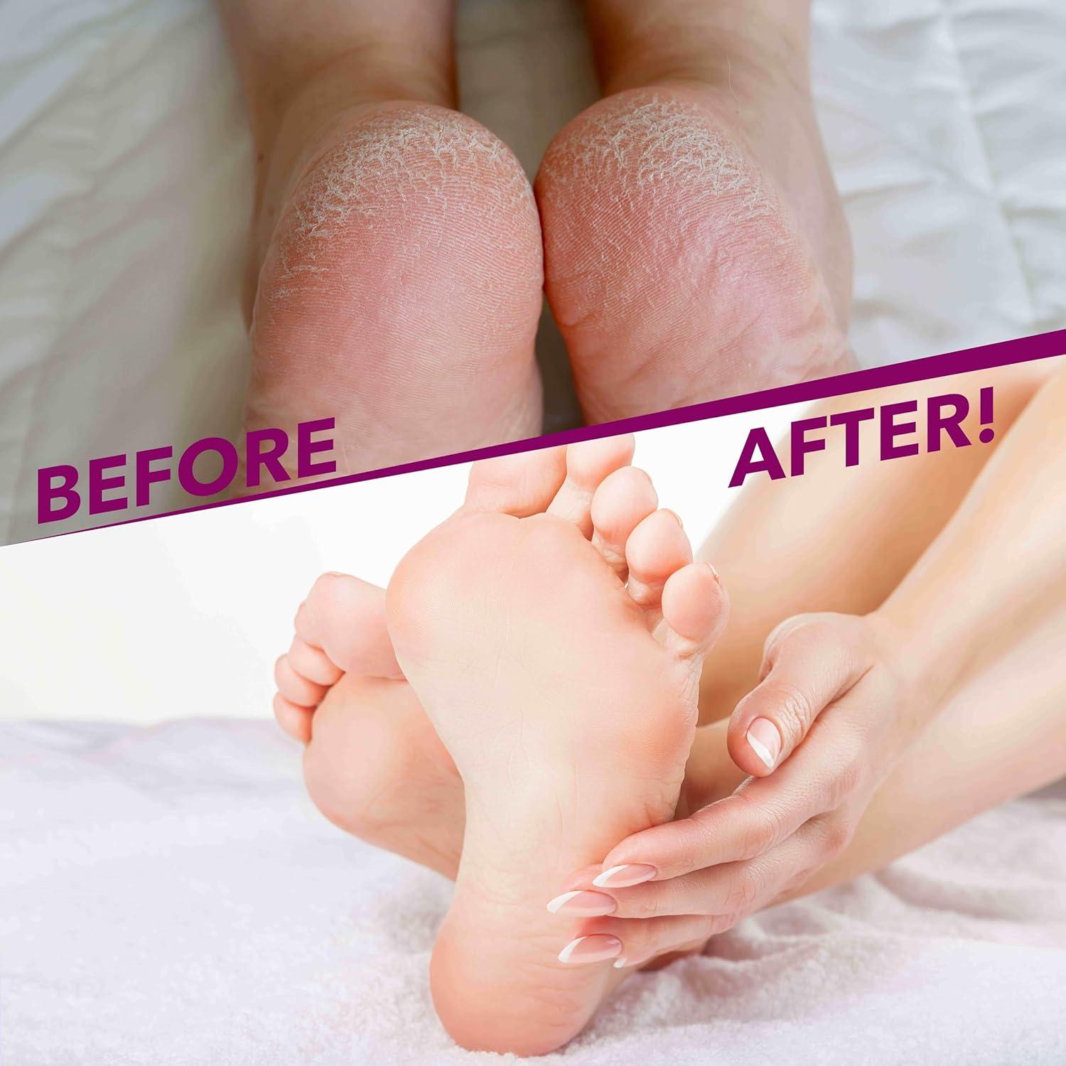image:imageGel Spa Moisturizing Gloves 1 Pair Spa Gloves Infused with Essential Oils to Soften Skin amp Lock in Moisture Gel Gloves for Dry Cracked HandsSocks